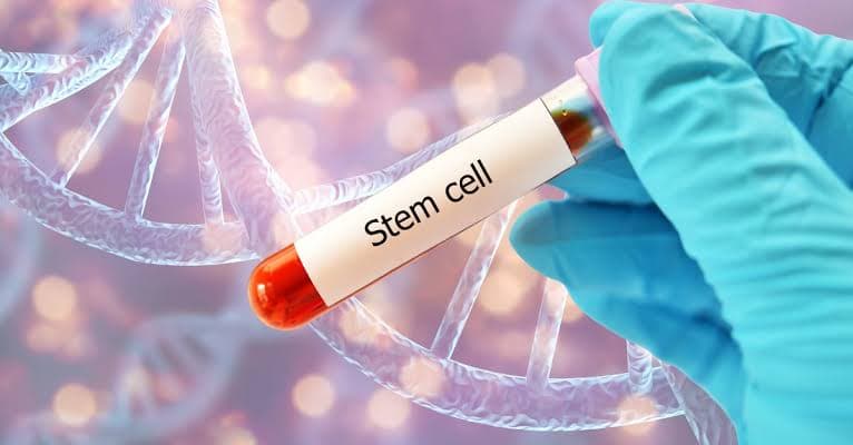 Stem Cell Therapy — gallery image 4